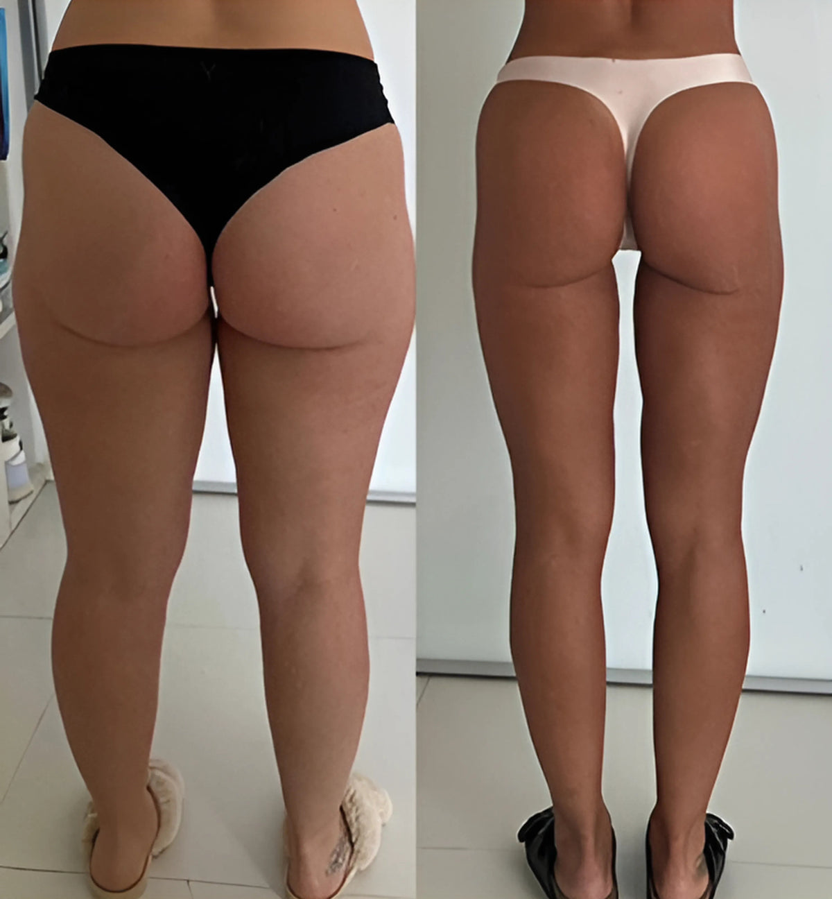 Prima e dopo