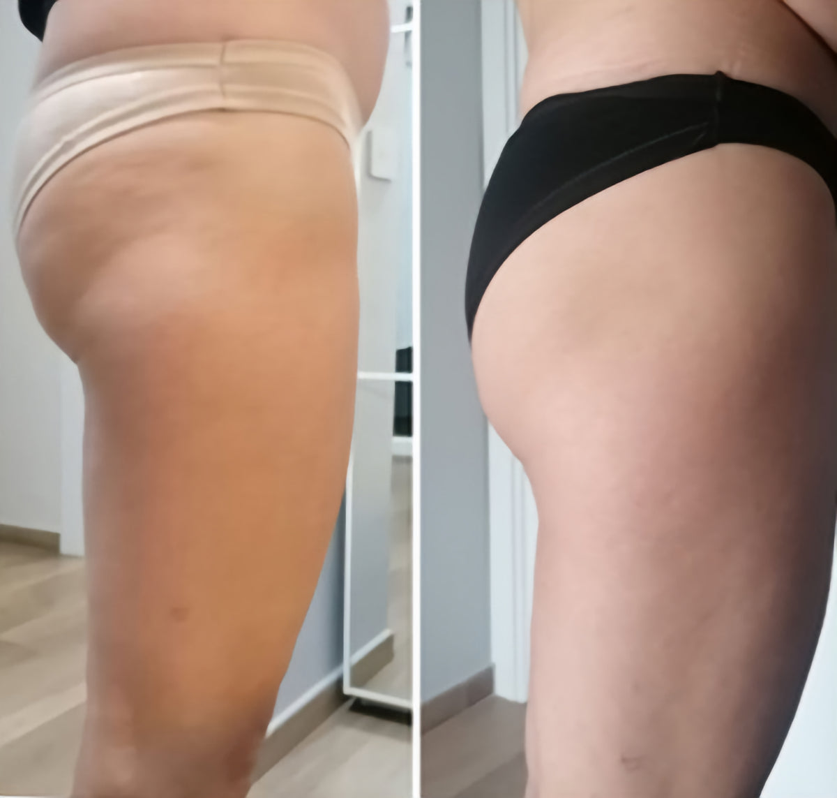 Roberta, prima e dopo 3 mesi